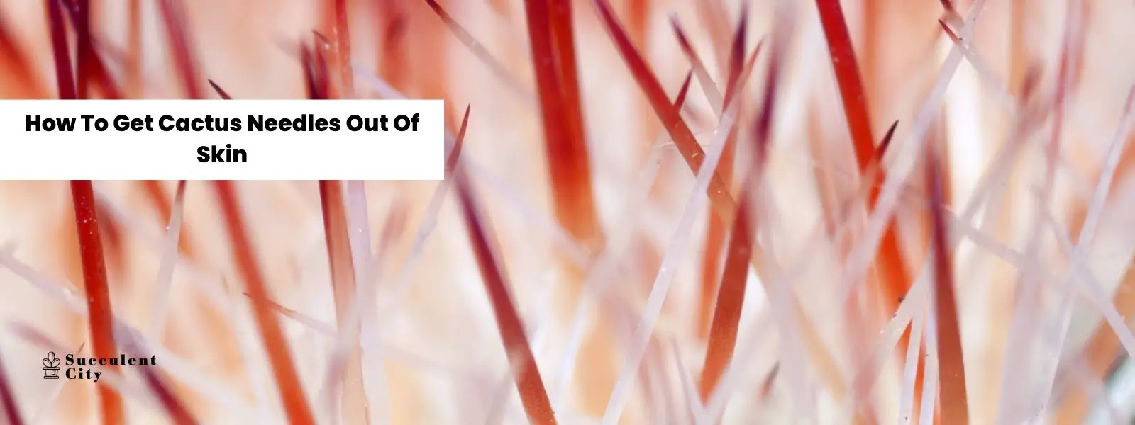 Cómo quitar las agujas de cactus/gloquidios de la piel